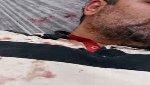 Büyükadadada gazeteci Güngör feci şekilde darp edildi! 